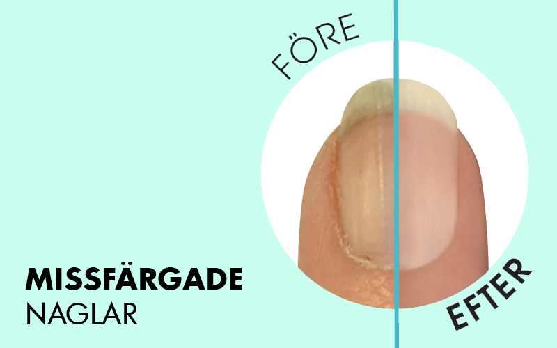 MISSFÄRGADE NAGLAR