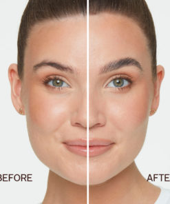 Brow Lift fore efter